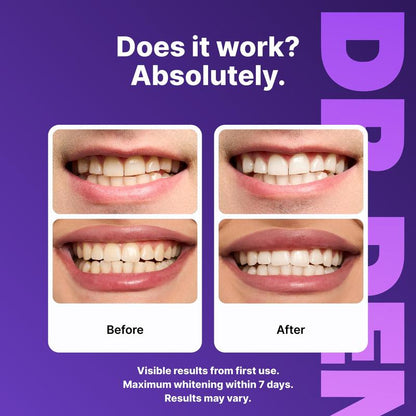 DR.DENT™ Teeth Whitening Strips