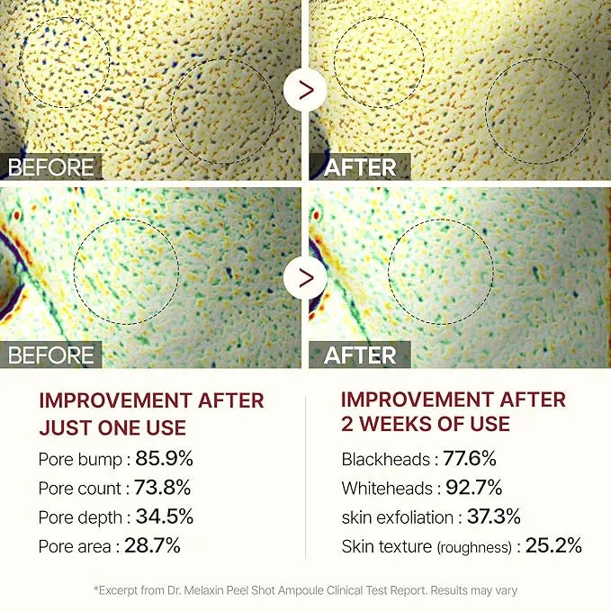 PoreClear™ Rice Serum